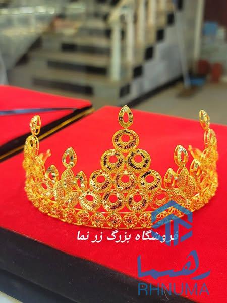 تاج های کاست و فیوژن آبکاری طلا