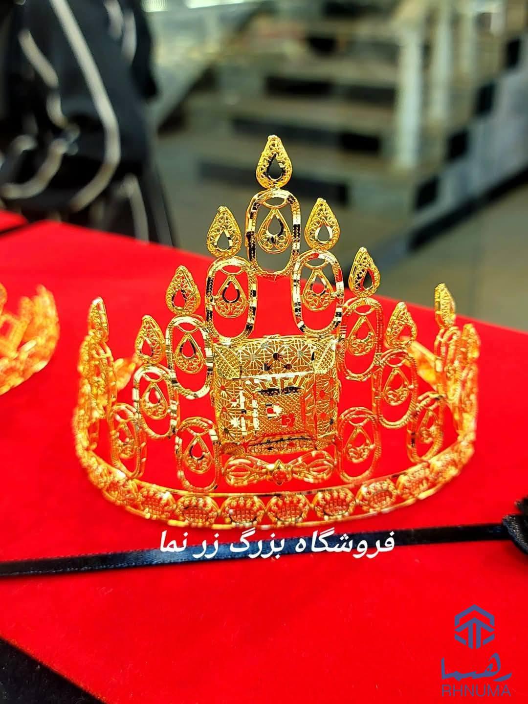 تاج های کاست و فیوژن آبکاری طلا
