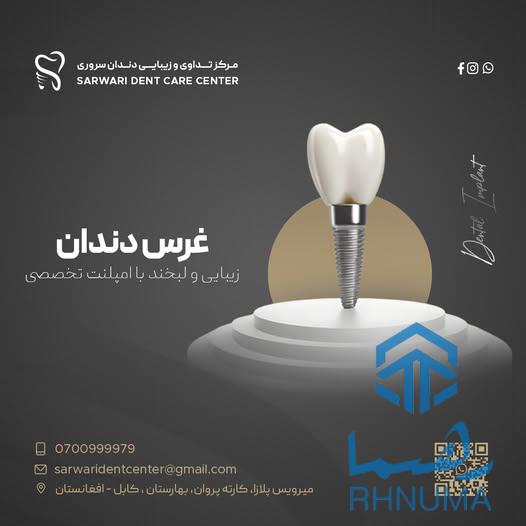 لبخندتان را با امپلنت دوباره کامل کنید!