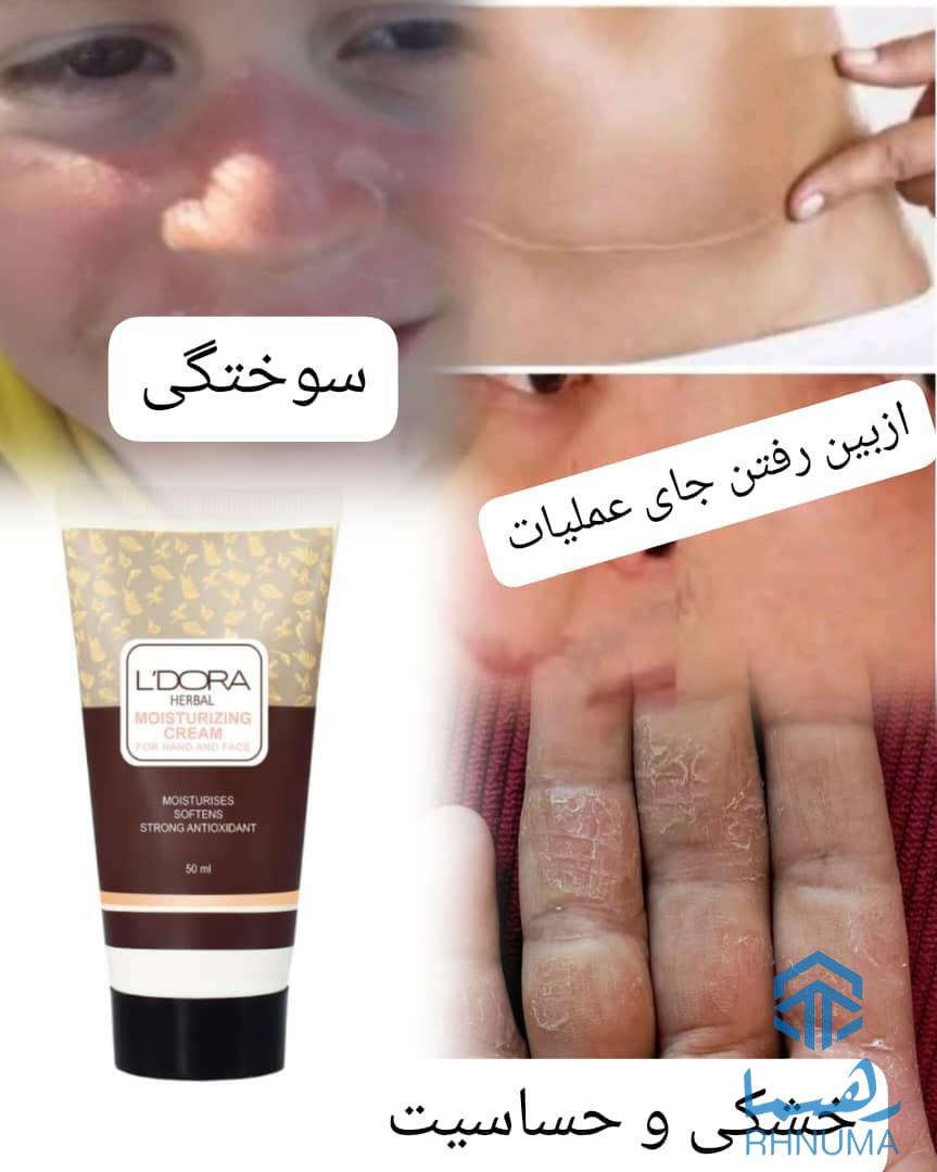 برای درمان این مشکلات فقد کرم جادویی دست و صورت، برای مشاوره و دریافت محصول به شماره وتسپ زیر پیام بفرستین: